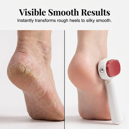 Double-Sided Foot File